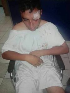 Uno de los normalistas de Tiripetío, Michoacán, fue operado con éxito y se salvó de perder un ojo a consecuencia de los golpes propinados por la policía municipal de Aguascalientes Foto La Jornada 